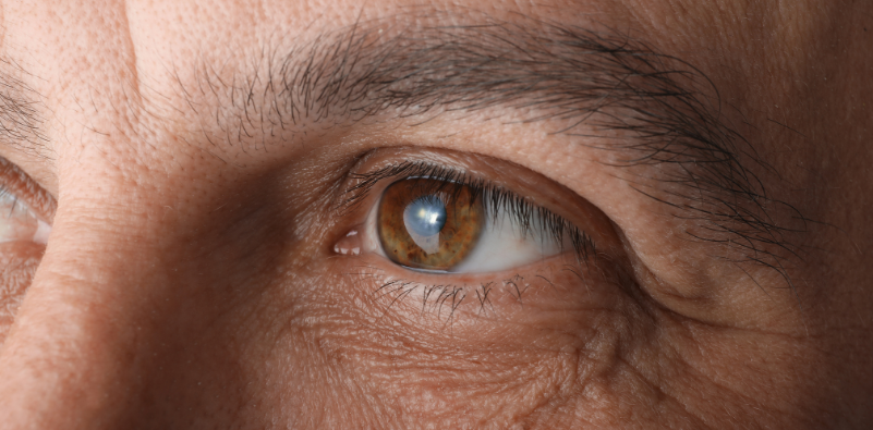 A close-up of a man’s eye